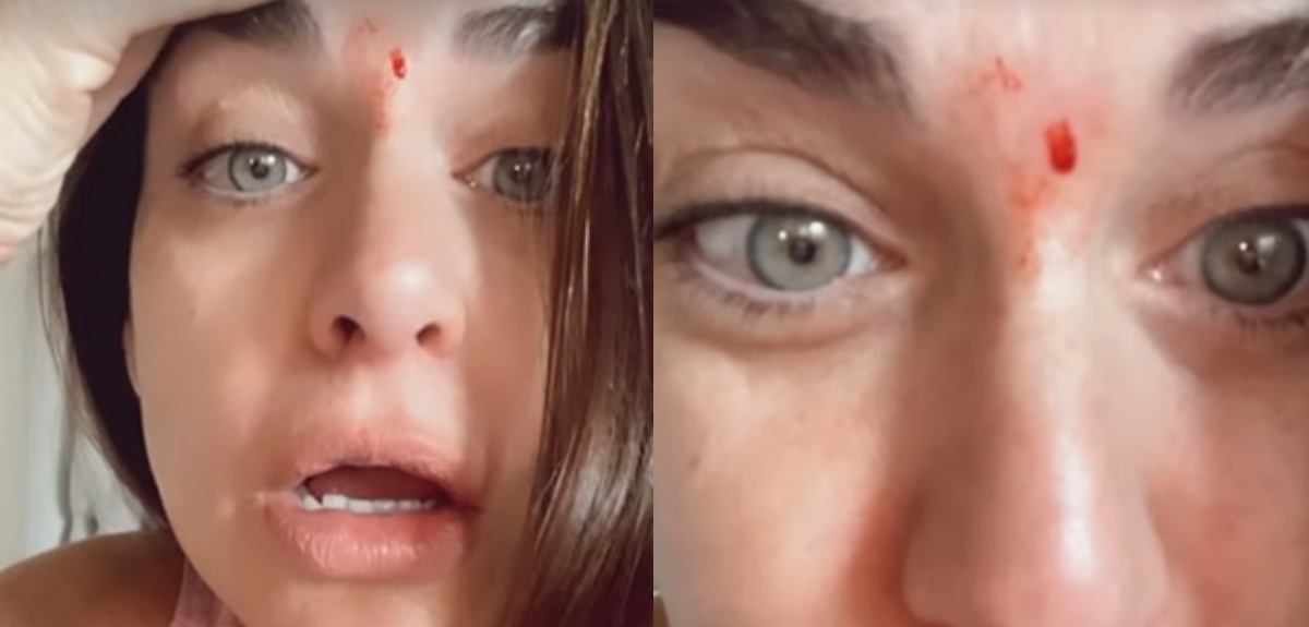 Ingrid Cruz terminó sangrando tras sufrir insólito accidente casero: 