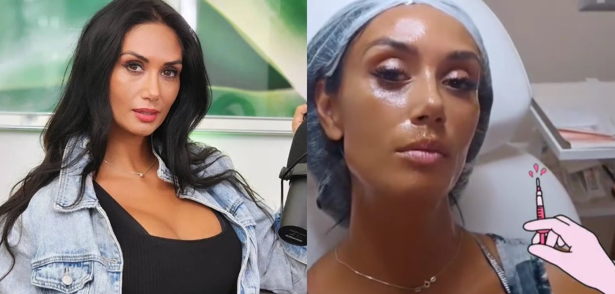 Pamela Díaz mostró innovador procedimiento estético que se hizo en el rostro: 