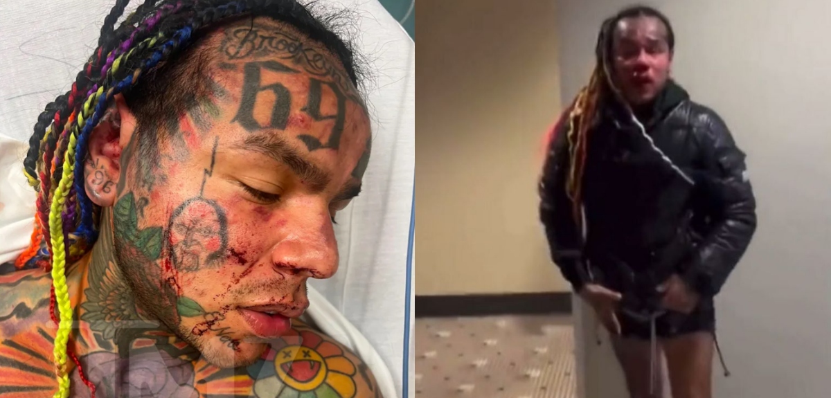 Rapero Tekashi 6ix9ine fue hospitalizado tras sufrir brutal agresión en Florida