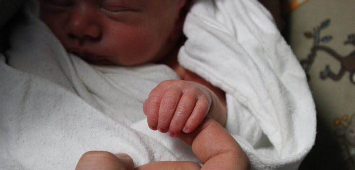 Bebé con gemelo parásito