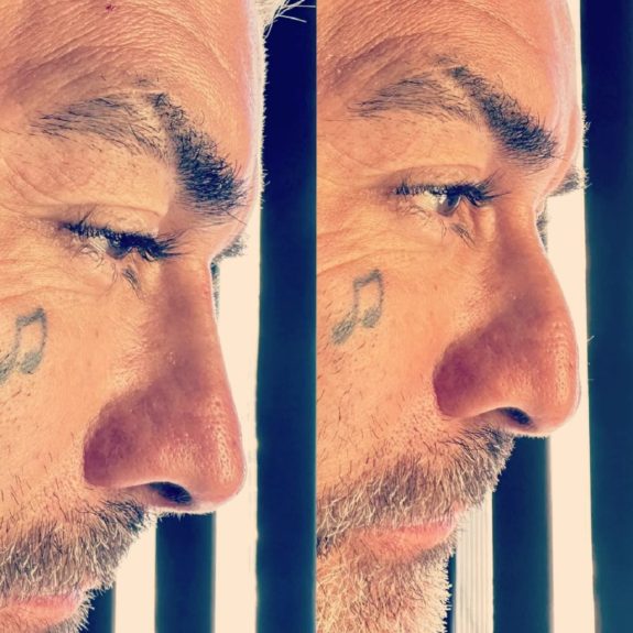 DJ Méndez retoque estético cara