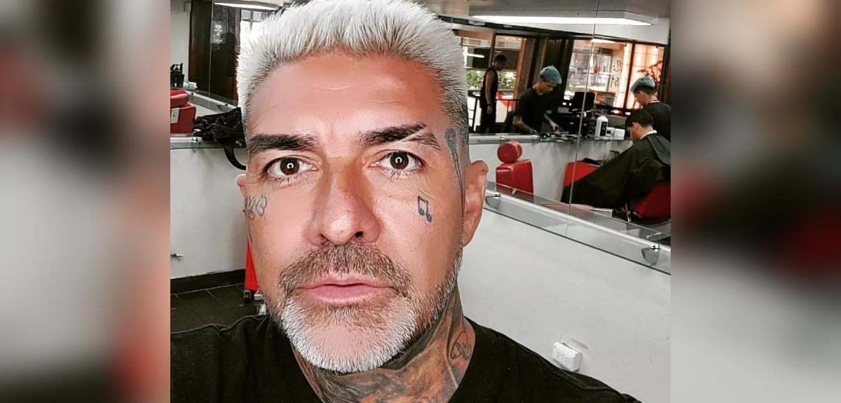 DJ Méndez sorprendió al mostrar resultado de una intervención estética en su rostro: 