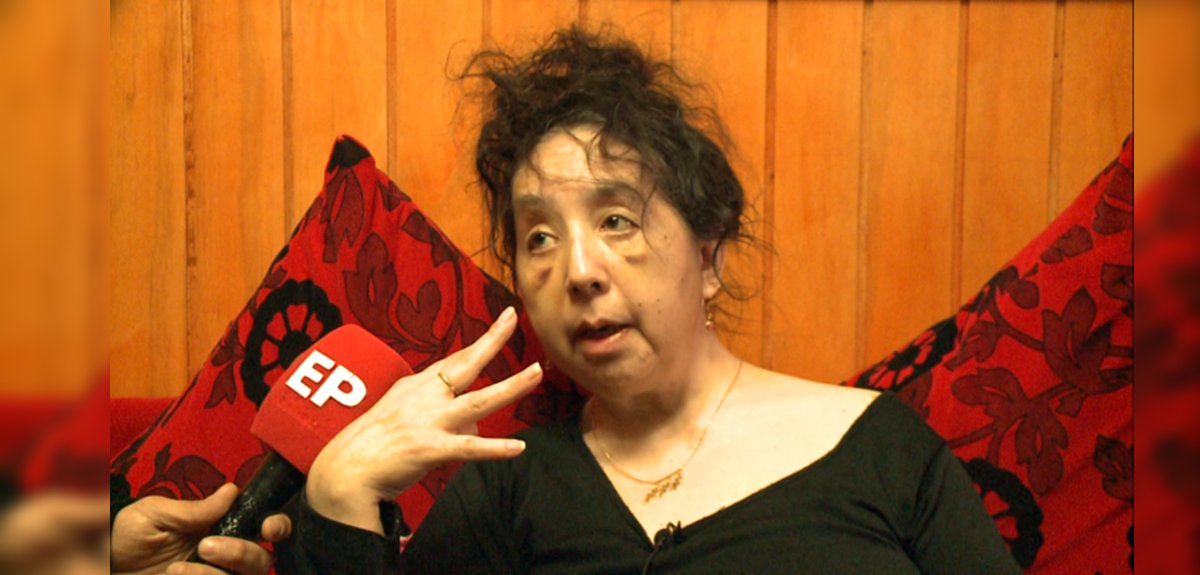 Familia de la región de Magallanes pide ayuda al vivir con rara enfermedad: madre e hijos la tienen