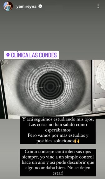 Yamila Reyna salud estudios ojos