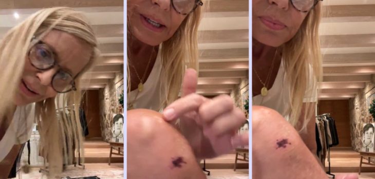 Cecilia Bolocco herida rodilla