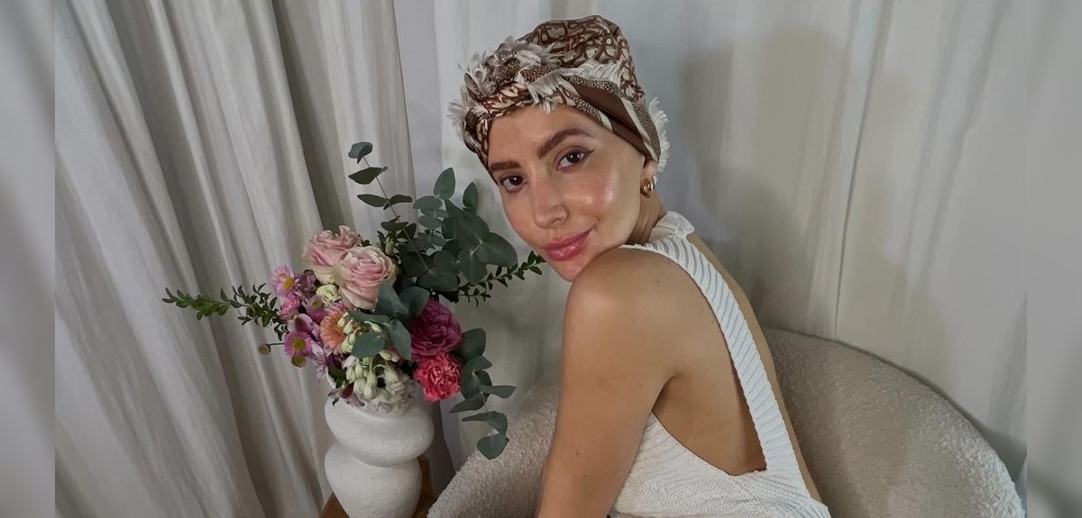 Aylén Milla mostró efectos secundarios de su tratamiento contra el cáncer: 