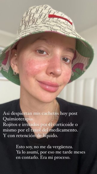 Aylén Milla compartió sensible video tras revelar cáncer: “Apenas enterada de mi diagnóstico...”