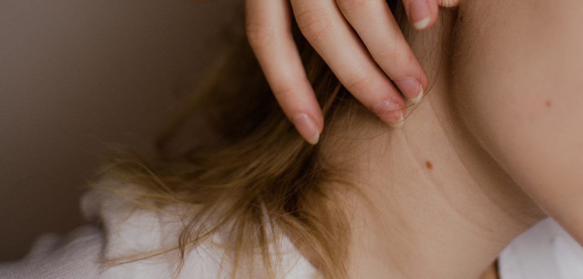 En el Día Mundial contra el Melanoma: conoce los cambios en la piel a los que hay que estar atentos