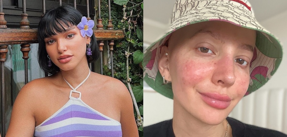 Helénia Melán habló de la dificultad que afrontó Aylén Milla al hacer público su cáncer: 