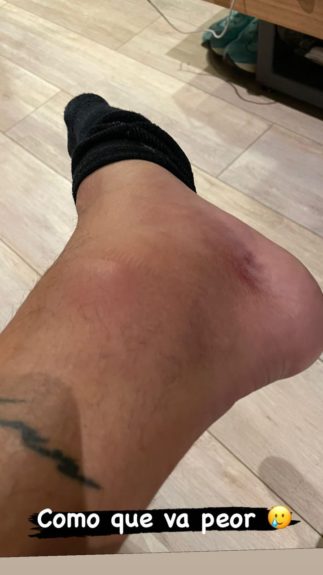 Cristián de la Fuente preocupó en redes al subir video en silla de ruedas: sufrió compleja lesión