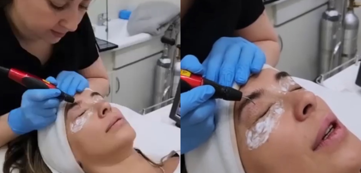 Pancha Merino recibió sus 50 años con tratamiento para rejuvenecer la mirada: conoce los resultados