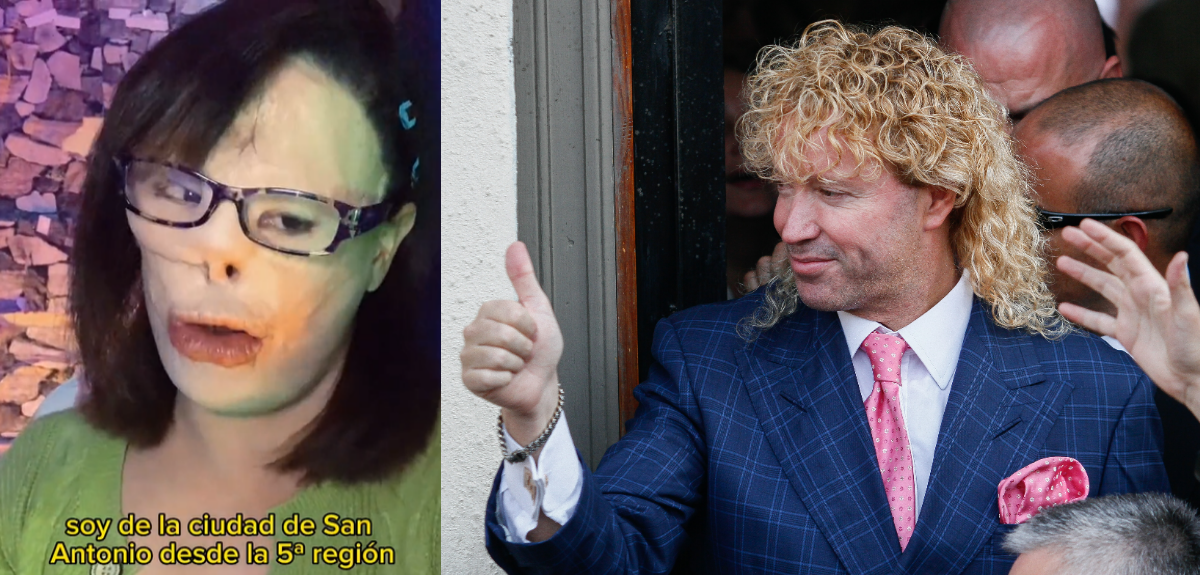 Streamer chilena pide ayuda a Leonardo Farkas para cubrir costoso tratamiento dental