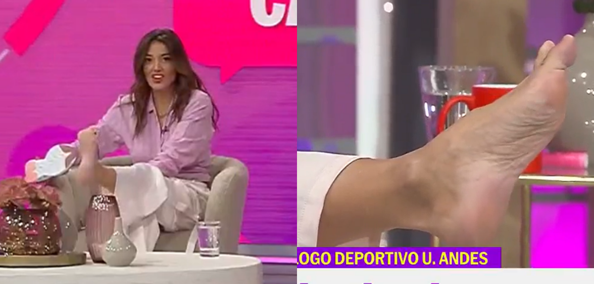 Yamila Reyna sorprendió en 'Hoy se habla' al mostrar su juanete: 