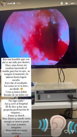 Anahí sufrió accidente a meses de su presentación con RBD: “Estoy en shock”