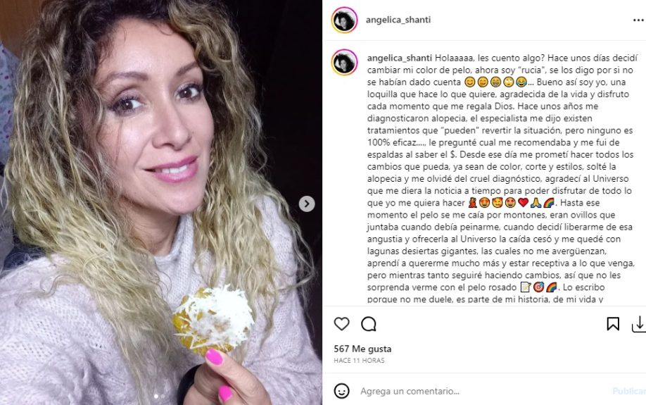 Angélica Sepúlveda reflexión alopecia