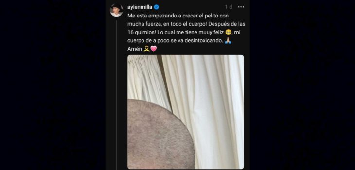Aylén Milla pelo