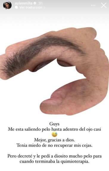 Aylén Milla mostró avance con su cabello