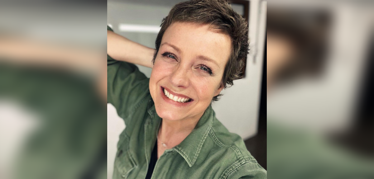 Claudia Conserva se realizó procedimiento estético en su rostro: animadora mostró el resultado