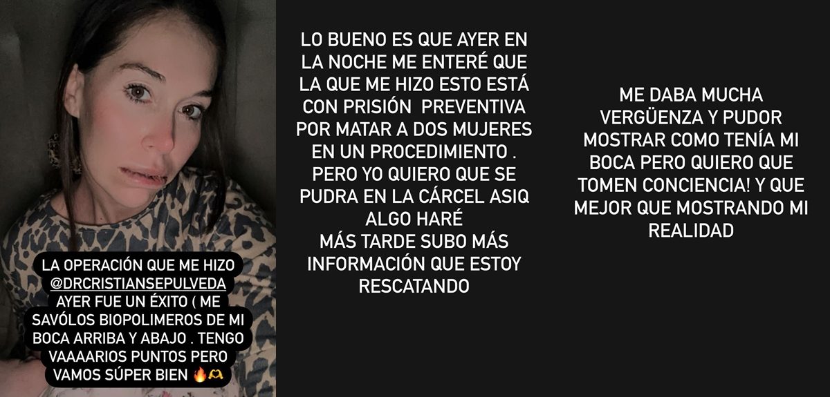 Vale Roth se sometió a importante operación: "Me daba mucho pudor, pero quiero que tomen conciencia"
