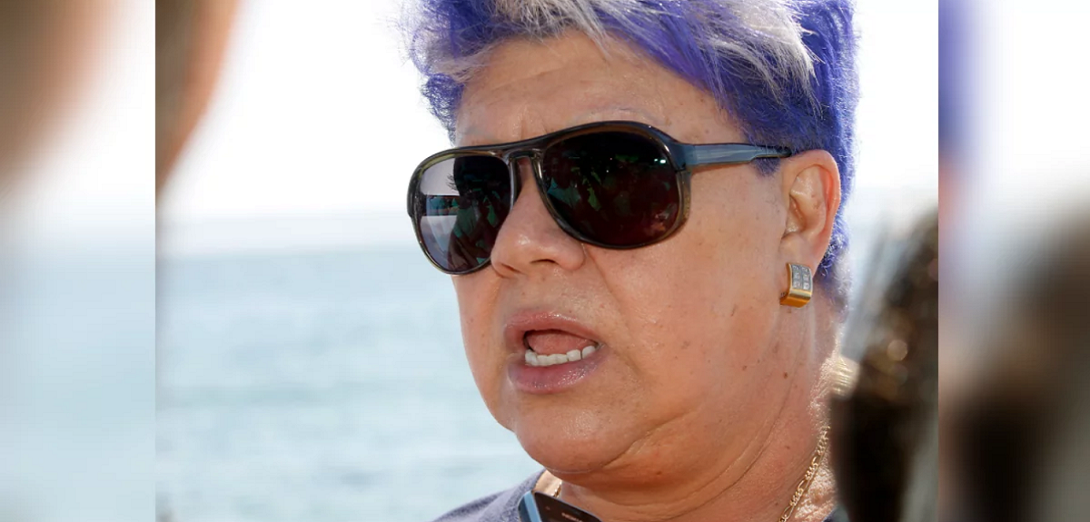 Patricia Maldonado y la impactante postal de cómo quedó su rostro tras grave accidente