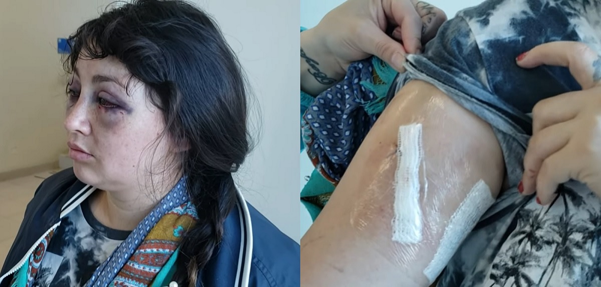 Crudo relato de magallánica atacada por pareja mientras sostenía a su bebé: 