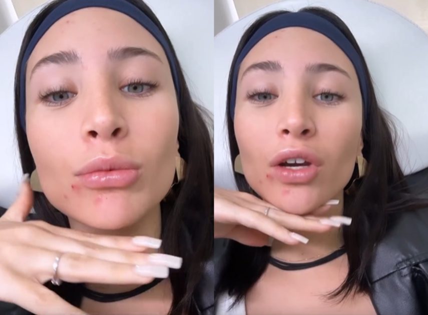 Maite Phillips mostró retoque en sus labios