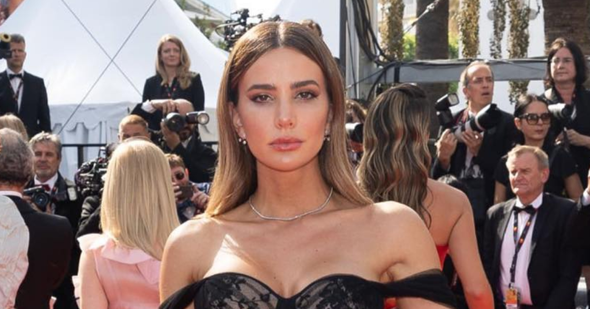 Aylén Milla evidenció los daños en su cuerpo tras las quimioterapias: “No es con ánimos de asustar”