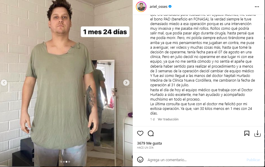 Ex Yingo, Ariel Osses, mostró su antes y después tras operación de bypass: “Pensé que me podía morir”