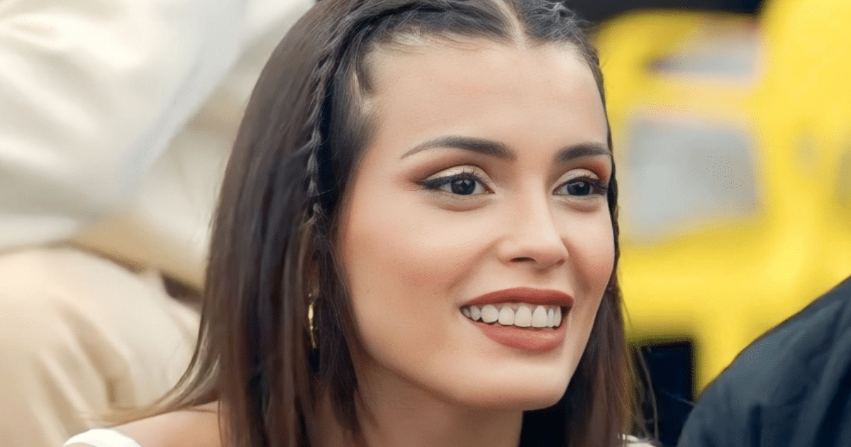 ¿Lo has notado? Especialista explica la reacción alérgica que afecta a Cony en Gran Hermano