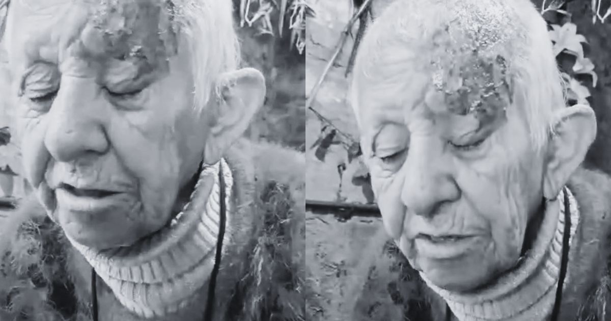 Adulta mayor fue quemada con ácido en La Florida: desconocidos también mataron a sus perros