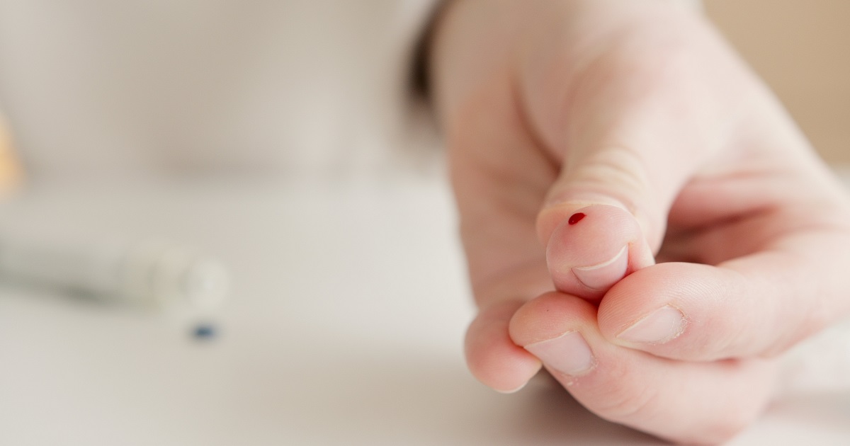 ¿Manchas oscuras en la piel? Conoce los síntomas más comunes de la diabetes