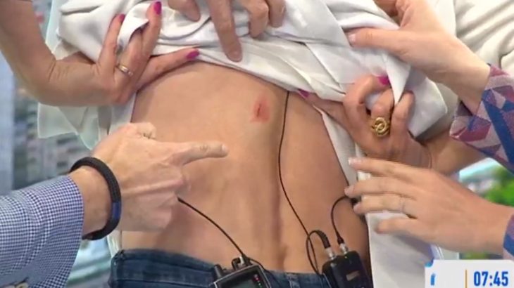 Karen Doggenweiler herida