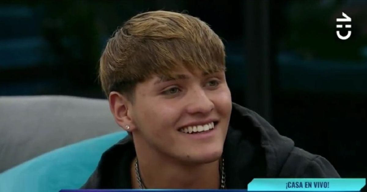Tras salir de Gran Hermano: Hans se sometió a retoque estético en su rostro y mostró el resultado