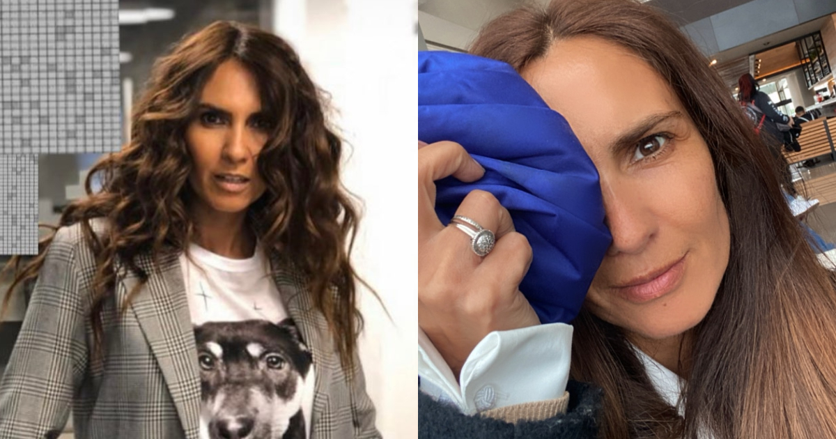 Yazmín Vásquez y la operación a la que se sometió por uno de sus ojos: “Se me cayó un párpado”