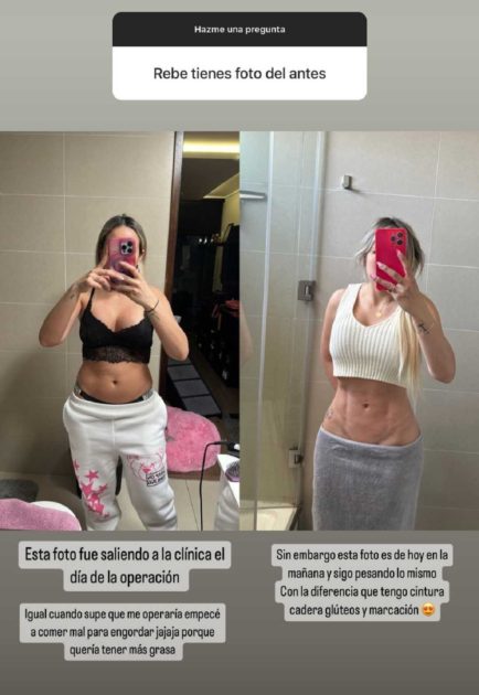 Rebeca Naranjo cambio cirugía estética