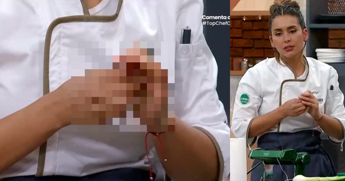 El fuerte accidente que sufrió Carlyn Romero en Top Chef VIP: 