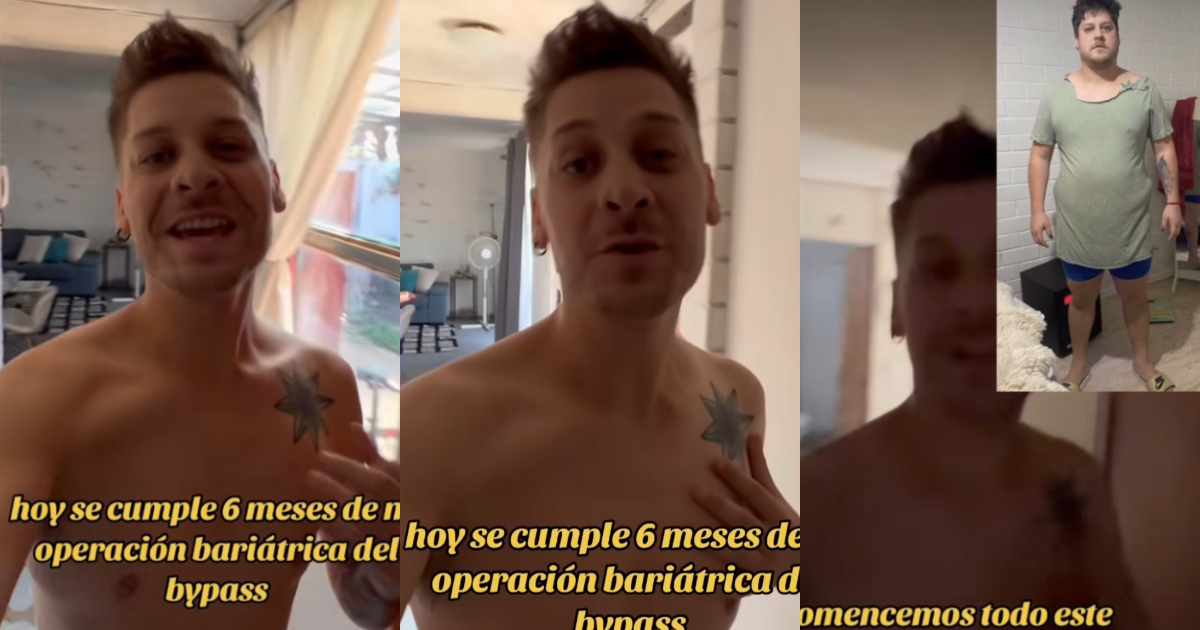 Ex Yingo, Ariel Osses, mostró nueva apariencia a seis meses de operación: “Ya son 55 kilos menos”