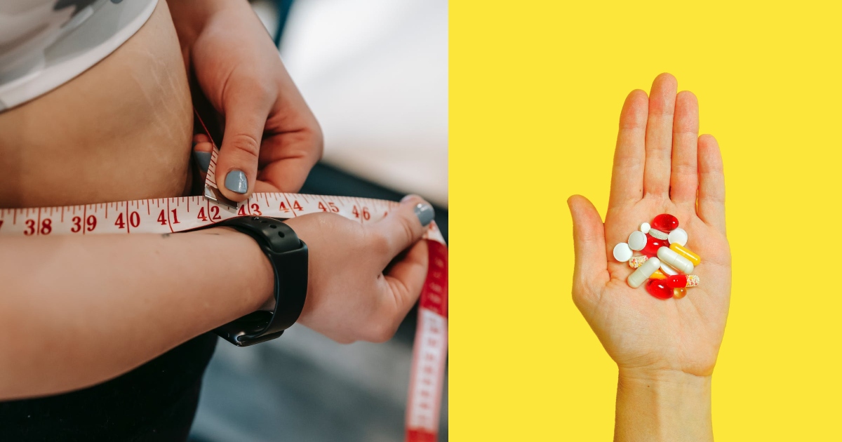 Cirugía bariátrica y suplementación