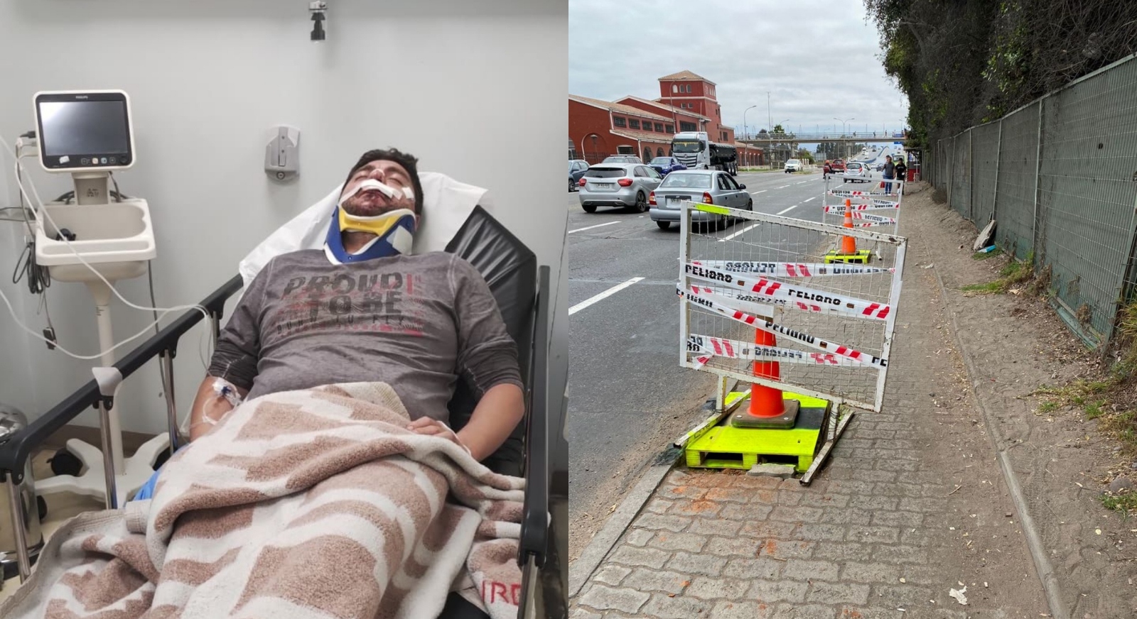 Turista perdió 7 piezas dentales tras caer de bicicleta por acera en mal estado en La Serena