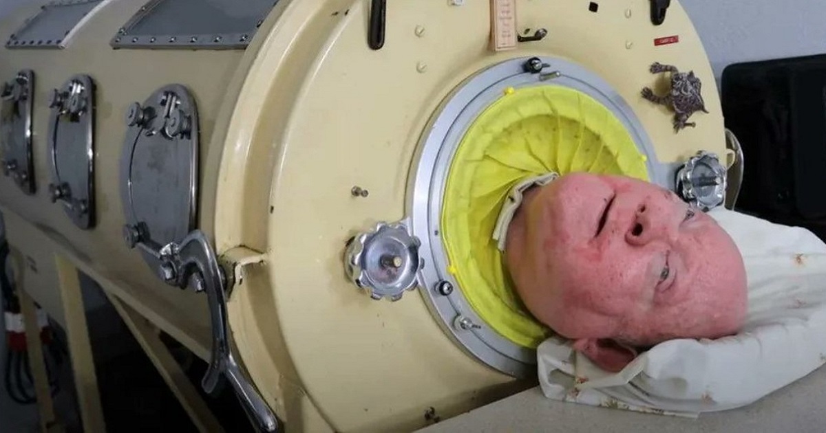 ¿Quién era Paul Alexander? Muere el hombre que vivió en un “pulmón de acero” durante 70 años