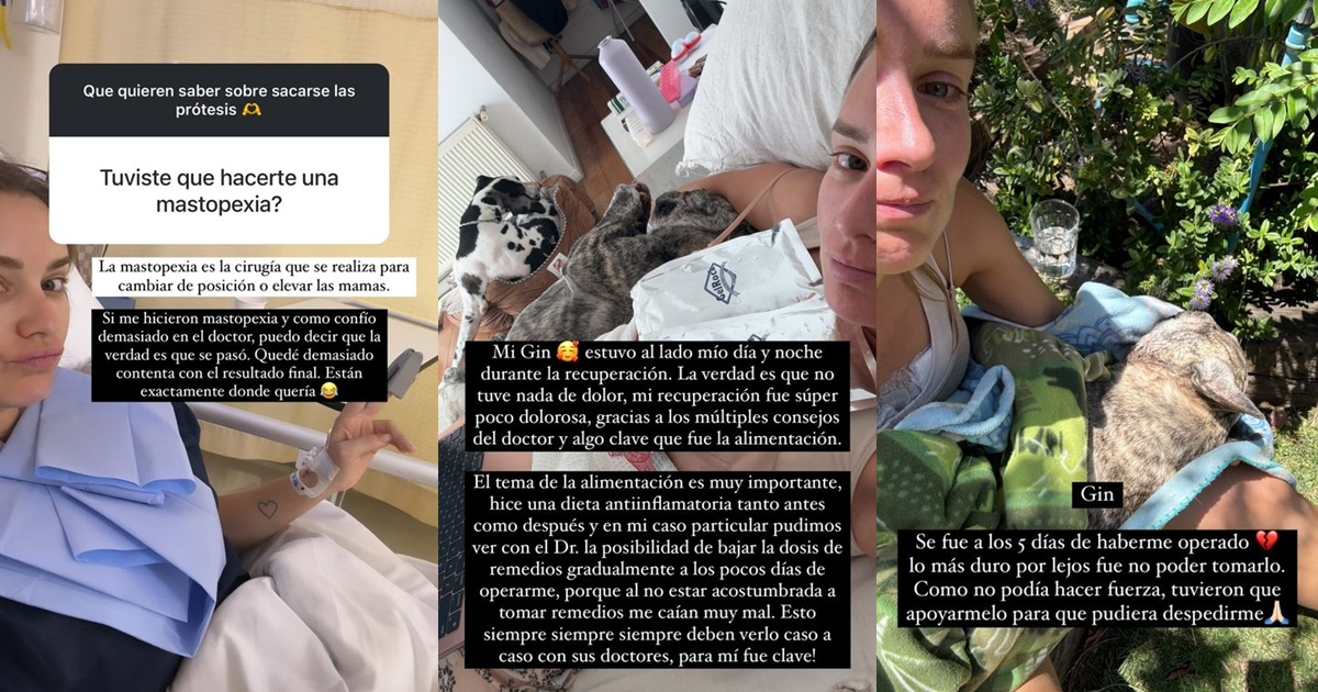 Kika Silva y por qué decidió retirarse sus implantes mamarios: "No soportaba tenerlos dentro mío"