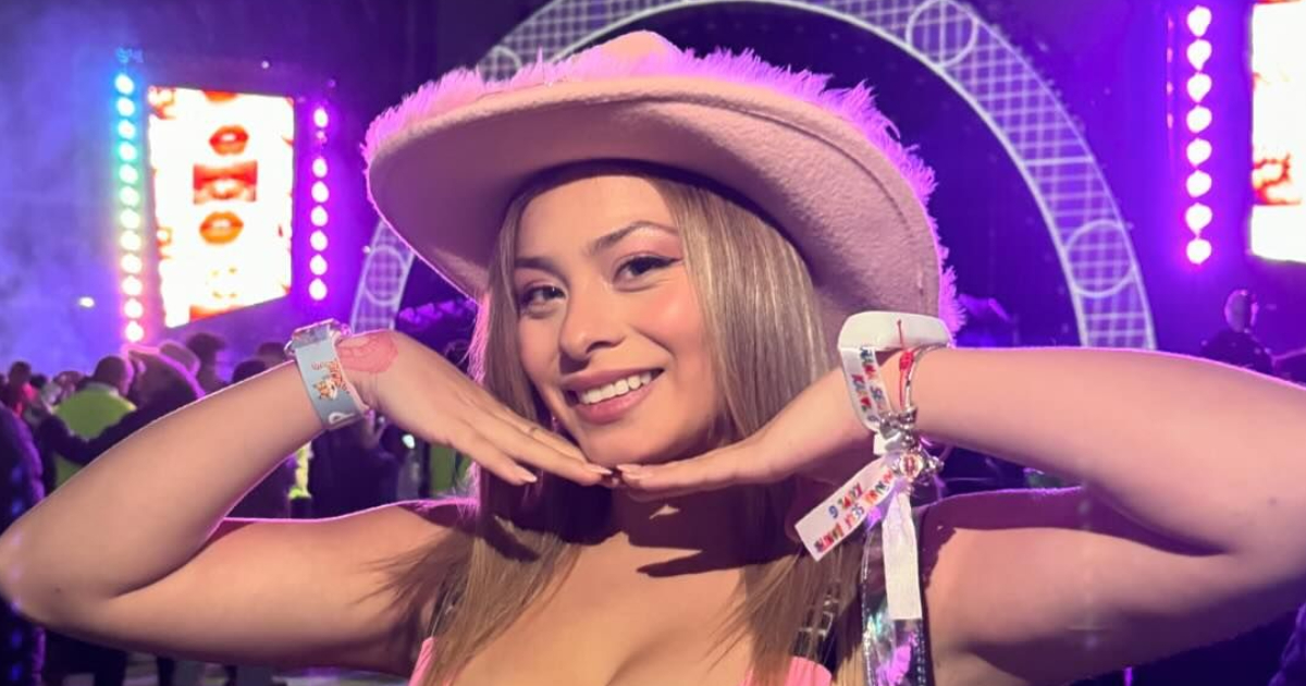 Skarleth respondió a fans preocupados por procedimiento estético en su rostro: “Salen moretones”