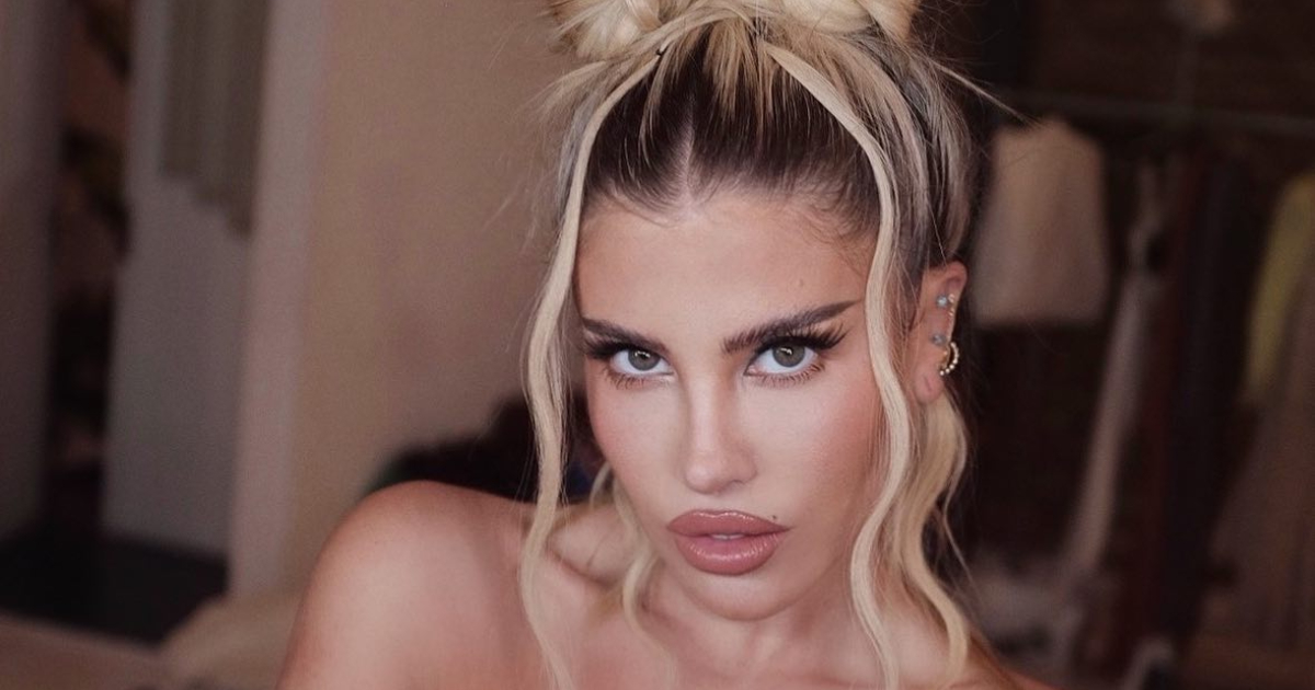 Coté López explicó novedoso procedimiento estético al que se sometió: “Lo usan las Kardashians”