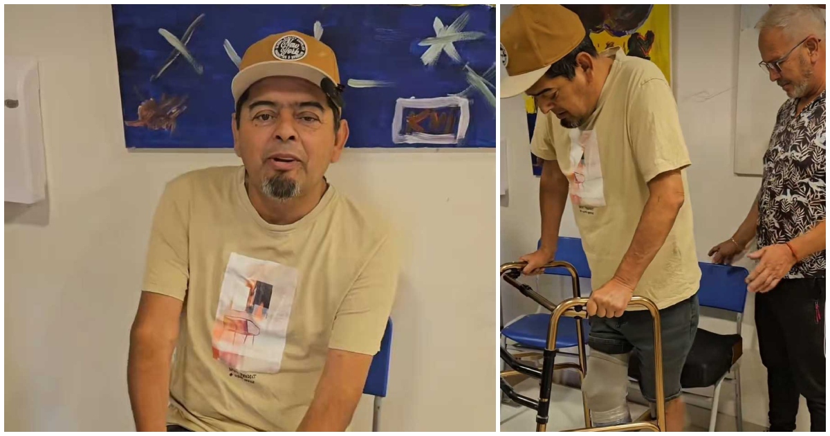 Mauricio Medina mostró cómo avanza su recuperación tras sufrir amputación: probó su prótesis