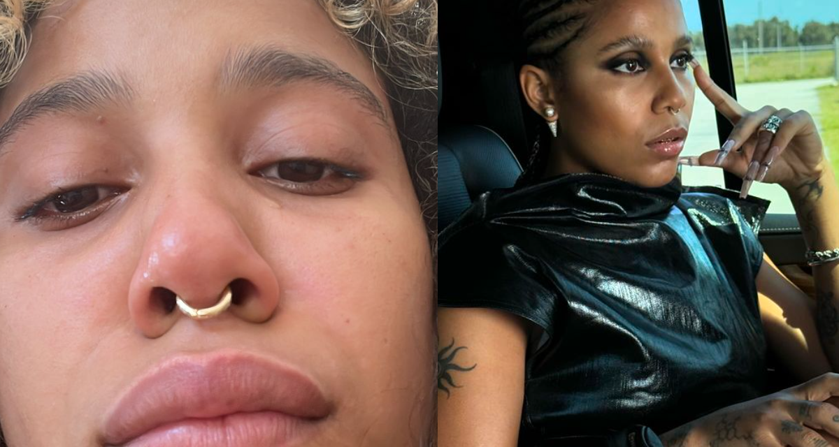 Imágenes sensibles: Tokischa sufrió doloroso accidente en medio de su gira