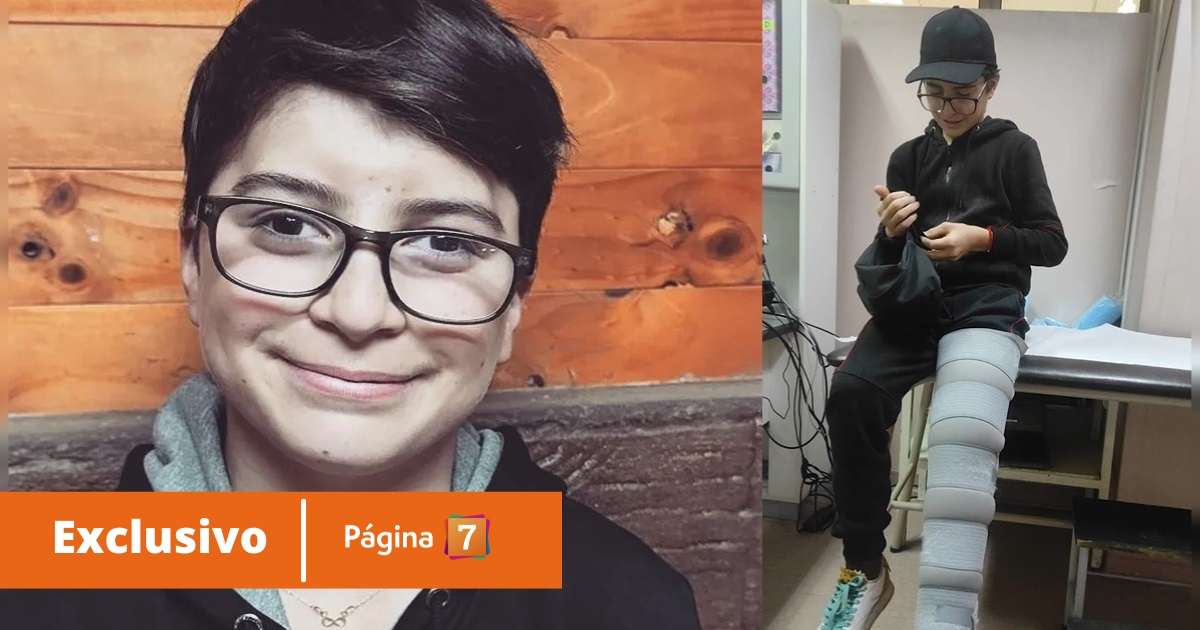 El accidente que dejó con fractura a Joaquín de Contra Viento y Marea: 