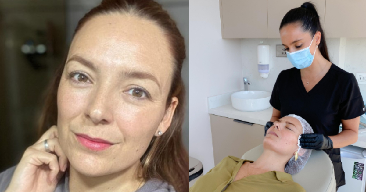 Janis Pope detalló procedimiento estético que realizó en su rostro: “Me costó tomar la decisión”