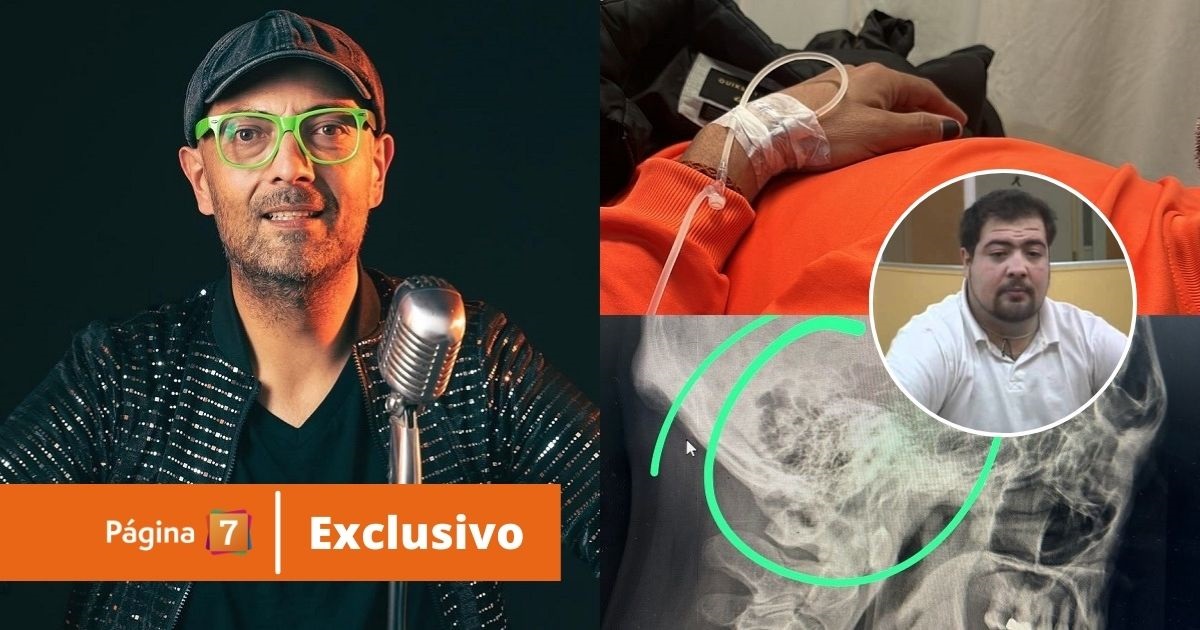Marcelo Castillo, ex 'Guatón Mamón', perdió la memoria por horas tras accidente: 