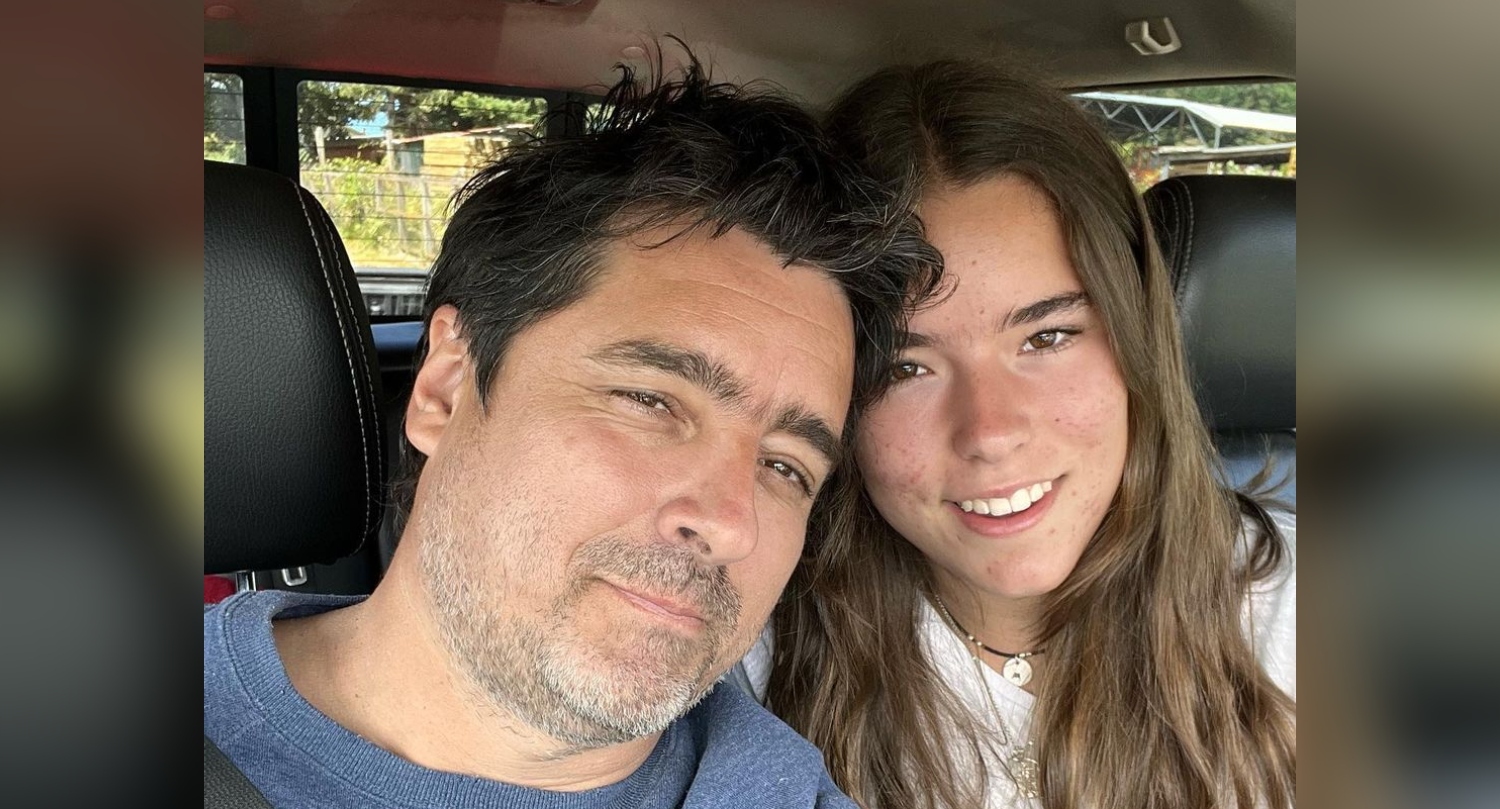 Milagros Zabaleta mostró cómo quedó su cara por el estrés: 