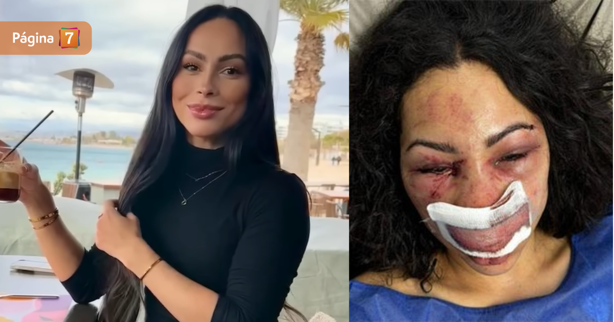 Turista brasileña fue brutalmente agredida en Las Condes: amiga aseguró que 